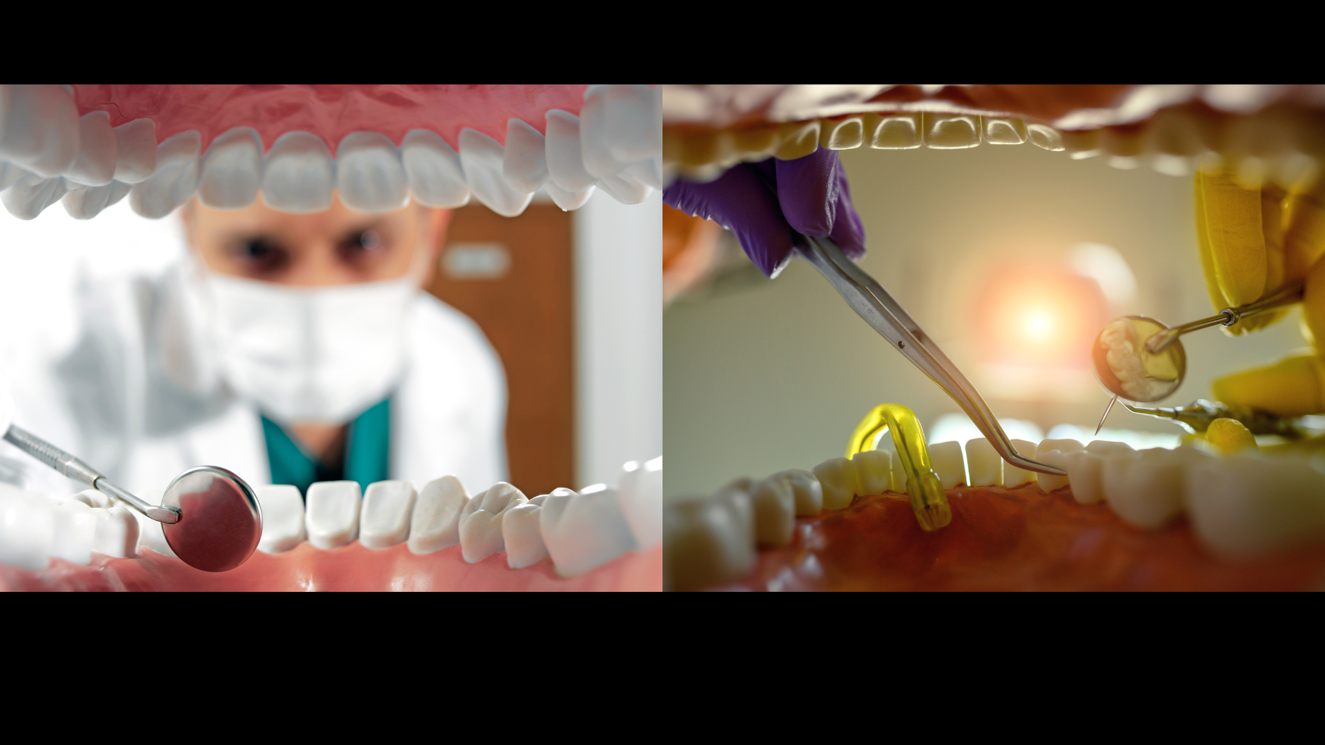 The Lifesaving Routine: Understanding the Vital Importance of Regular Dental Checkups